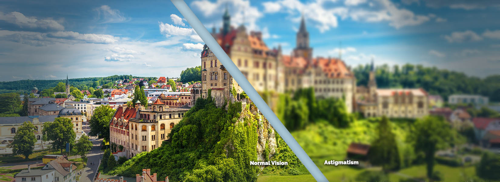 Astigmatism Treatment in Byron