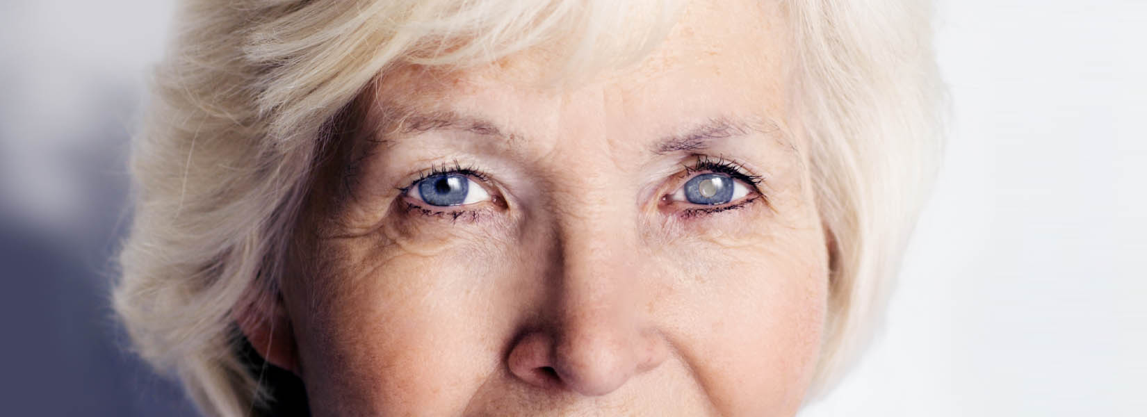 Cataract Surgery in Byron